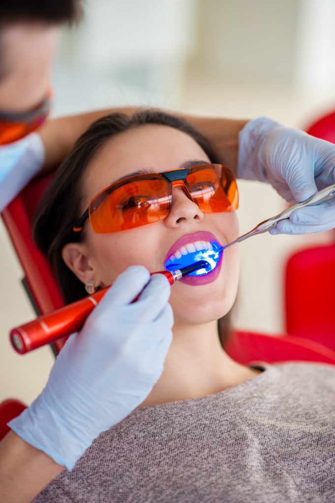 Blanqueamiento dental